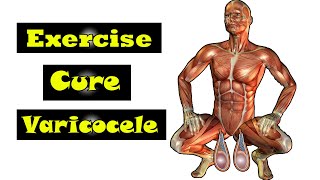 exercise for work cure varicocele [upl. by Neved251]