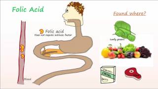 Megaloblastic Anemia Part 2 Folic Acid Deficiency Anemia [upl. by Fillian]