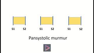 Pansystolic murmur [upl. by Trevar]