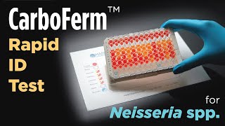 CarboFerm™ rapid carbohydrate test for Neisseria and Moraxella [upl. by Ennaecarg]