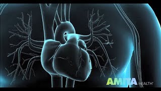 Coronary Angiography amp Cardiac Catheterization — AMITA Health [upl. by Adda257]