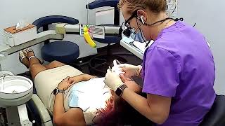 Dental visit  routine cleaning teeth by dental hygienist [upl. by Nara]