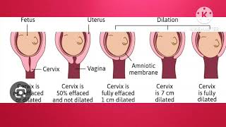 cervical effacement dilatation showuterine contraction  lectureenglishmedical education [upl. by Lenaj422]