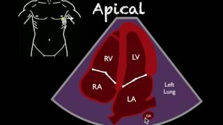 Bedside Ultrasound Basic Cardiac US [upl. by Neleag]