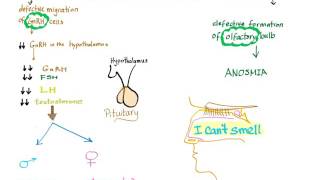 Kallmann Syndrome [upl. by Mahgem971]