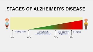 Diagnosing Alzheimer’s Disease [upl. by Yssirk157]