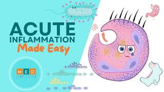 Acute Inflammation Made Easy [upl. by Jeraldine]