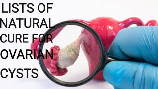 Causes of Ovarian Cyst Symptoms and Natural Treatment [upl. by Senaj]