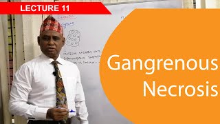 General Pathology Lecture 11  Gangrenous Necrosis [upl. by Retsbew]