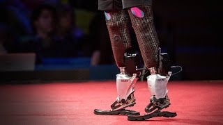 New bionics let us run climb and dance  Hugh Herr  TED [upl. by Hock318]