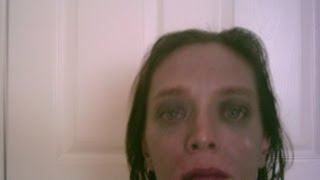 What happened to my skin Dental amalgams fillings mercury poisoning wwwhugginsappliedhealingcom [upl. by Alithea]