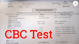 CBC Test Report  CBC Test Review  Investigation  Health tips bangla  Medi Health Point [upl. by Aleunam]