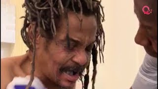 Majek Fashek in London hospital needs urgent assistance [upl. by Aznarepse]