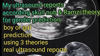 Gender prediction using ultrasound reports with help of Nub Ramzi amp skull theory [upl. by Odradlig]