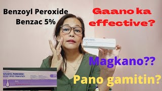 Gamot sa pabalik balik na acne at pimples  Benzoyl Peroxide review  Pimple and Acne Solution [upl. by Eba]