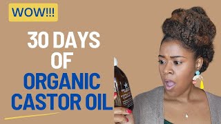 I Used CASTOR Oil for 30 Days and THIS Happened [upl. by Kellby]