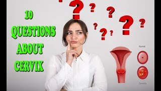 Cervix  10 questions to answer to help you decide whether or not to keep your cervix [upl. by Fitalludba]