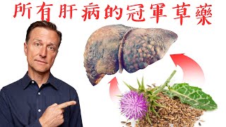 肝病的冠軍草藥奶薊脂肪肝肝炎和肝硬化自然療法柏格醫生 Dr Berg [upl. by Ihculo99]