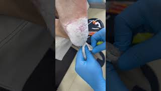 Charming pedicure video  Remove dead skin [upl. by Naerol]