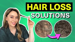 Hair Loss Treatments That Actually Work for Women amp Men  Dr Shereene Idriss [upl. by Mount637]