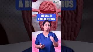 What You Need To Know About Adenomyosis  Dr Deepthi Jammi [upl. by Aryk]