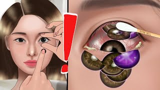 ASMR Removal of many contact lenses from the eye👁 Animation oshi no ko [upl. by Brinson351]