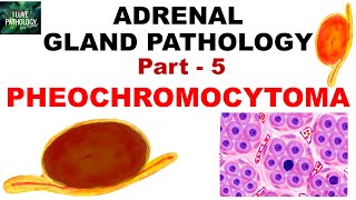 Adrenal Gland Pathology Part 5 PHEOCHROMOCYTOMA  Genetics  clinical features  Pathology [upl. by Modesty653]