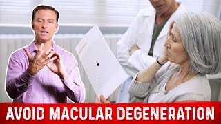 How to Prevent Macular Degeneration – Dr Berg [upl. by Tuttle]