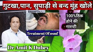 मुंह के कम खुलने का इलाज । इस तरह से करें 100 ठिक होने की गारन्टी  osmf treatment in Hindi [upl. by Allerbag]