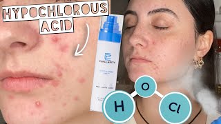 HYPOCHLOROUS ACID Sensitive Skin Ingredient for Acne amp Wound Healing PurClarity Revitalizing Mist [upl. by Kaitlynn472]