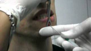 Aplicação de Piercing no Lábio  Diogo [upl. by Yetah]