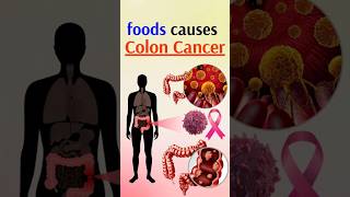 CANCER Causing Foods You Eat Every Day [upl. by Annirtak]