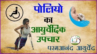 Treatment For Polio In Ayurveda  Causes Signs and Symptoms Of Polio [upl. by Marigolda376]