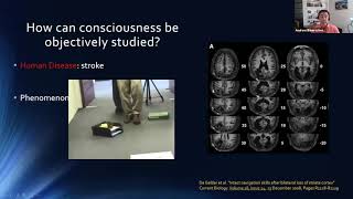 Neurology Lectures Coma and other disorders of consciousness with Dr Bauerschmidt [upl. by Marley]