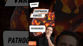 Pathophysiology of esophageal varices pharmacy medicine nursing [upl. by Ojybbob]