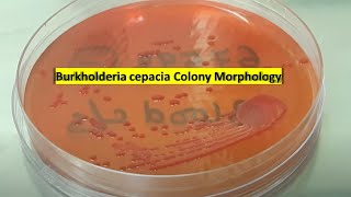 Burkholderia cepacia growth on Macconkey agar [upl. by Lenore]