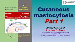 Cutaneous Mastocytosis Part 1 [upl. by Southworth745]