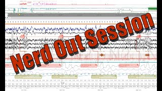 Polysomnography Nerd Out Severe OSA Fixed REM Rebound PAP Titration Progression Delta Raw Data [upl. by Carlyle]