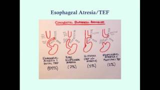 Newborn Gastrointestinal Disorders Part 1  CRASH Medical Review Series [upl. by Evangeline720]