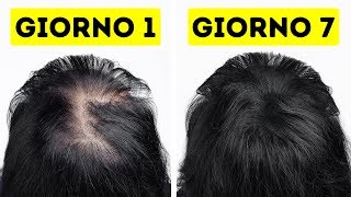 Ho Reso I Miei Capelli Più Sani E Forti In Appena Una Settimana [upl. by Heck]