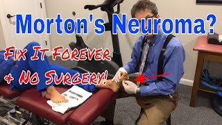 Mortons Neuroma Fix it Forever [upl. by Divadnhoj255]