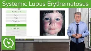 Systemic Lupus Erythematosus SLE in Children – Pediatrics  Lecturio [upl. by Blondy227]