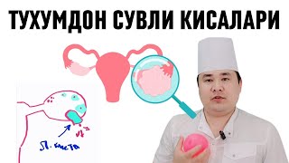 Функционал киста Фолликуляр ва Лютеин кисталари сабалари Асорати ва Даво чоралари хақида Исчанов [upl. by Spain175]