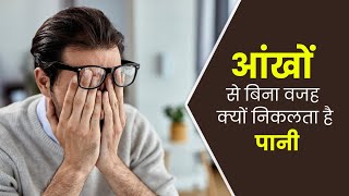 आंखों से बिना वजह क्यों निकलता है पानी  Common Causes Of Epiphora  Watering Eye Causes Symptoms [upl. by Mycah279]