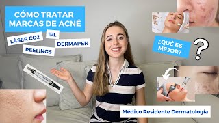 CÓMO TRATAR MARCAS DE ACNÉ EN LA CARA SEPTIEMBRE 2021  LÁSER CO2 PEELINGS DERMAPEN ¿EL MEJOR [upl. by Tibbs]