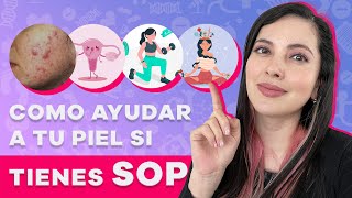 Síndrome de Ovario Poliquistico y PIEL Tips de una Dermatóloga [upl. by Ididn956]