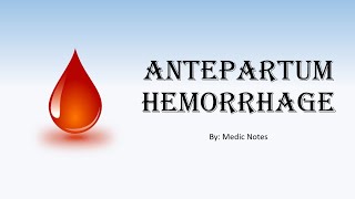 OampG Antepartum hemorrhage  causes history taking PE findings investigation management [upl. by Koosis256]