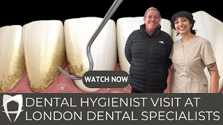 Dental Hygienist Visit At London Dental Specialists [upl. by Cookie305]