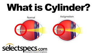 What is Cylinder in an Eyewear Prescription With SelectSpecscom [upl. by Anissej789]