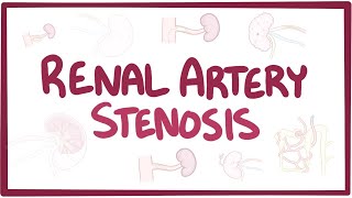 Renal artery stenosis  causes symptoms diagnosis treatment pathology [upl. by Rolecnahc]